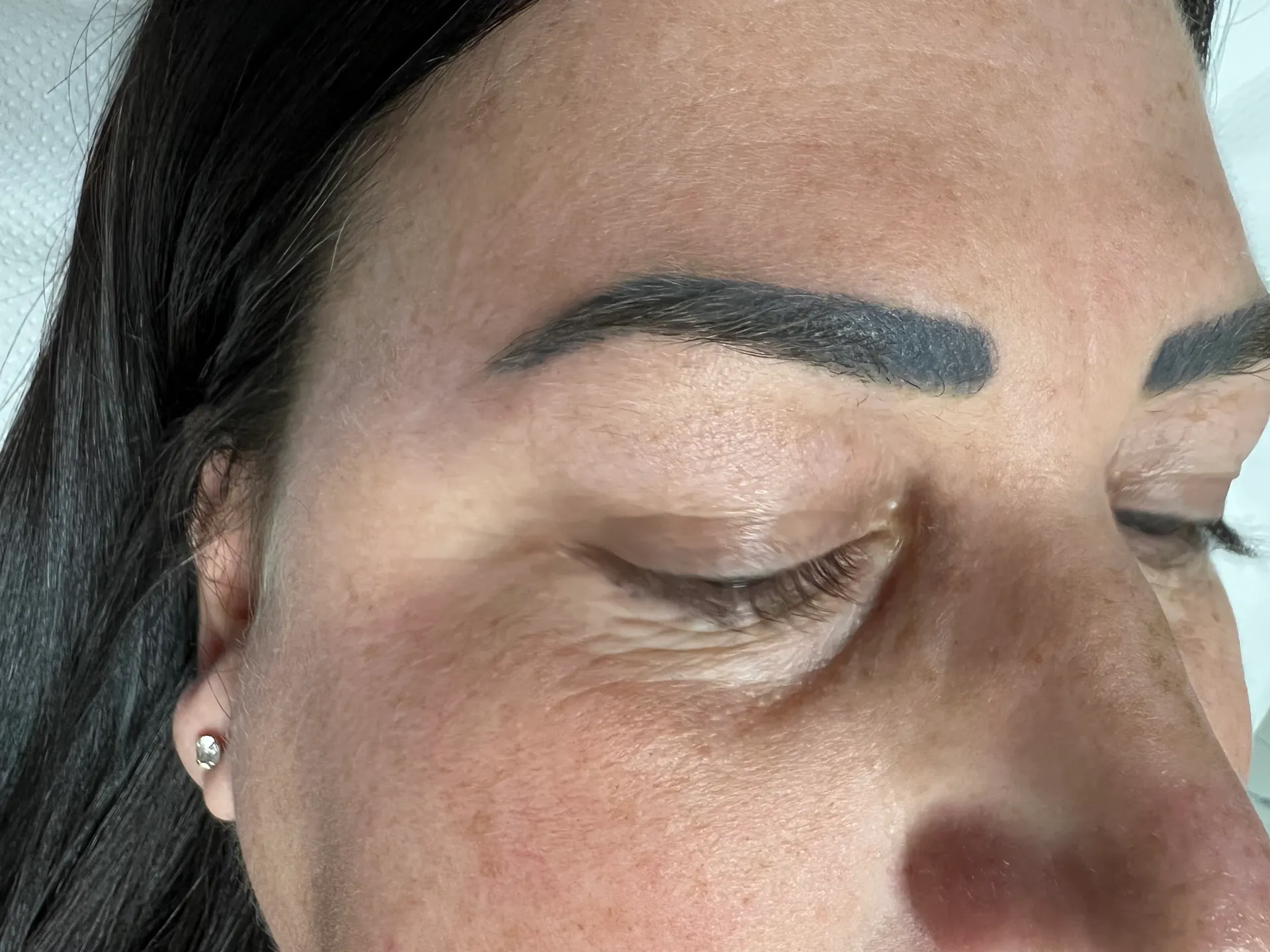 After - Before and after microblading tattoo removal at Mode Laser Skin Clinic showing fuller, defined brows
