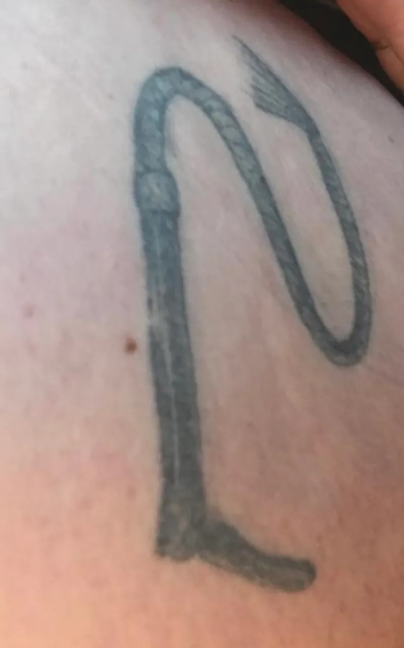 Tattoo before laser removal