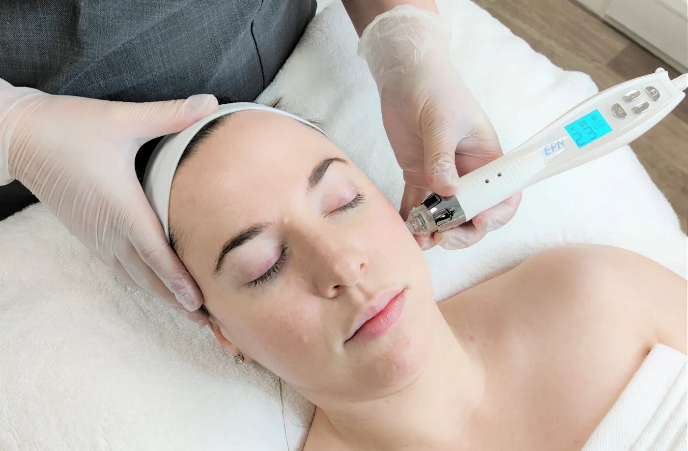 Micro-Needling