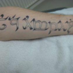 newbefore tattoo removal 3
